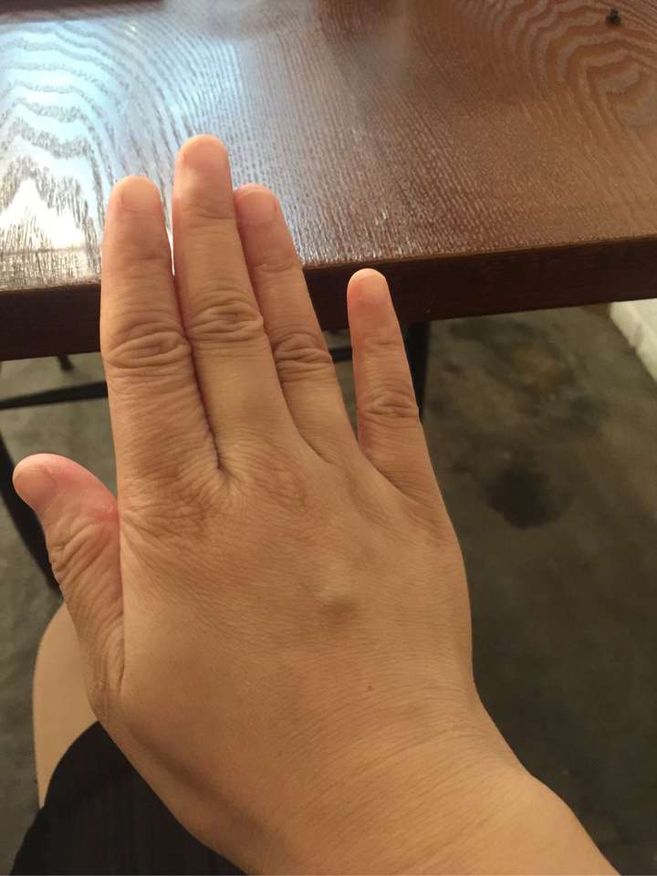 手长的难看是种怎样的体验?