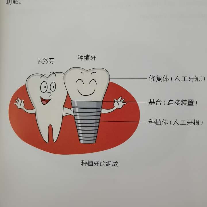 「种植牙」可不是把牙齿的种子种到骨头里再生长出来的!