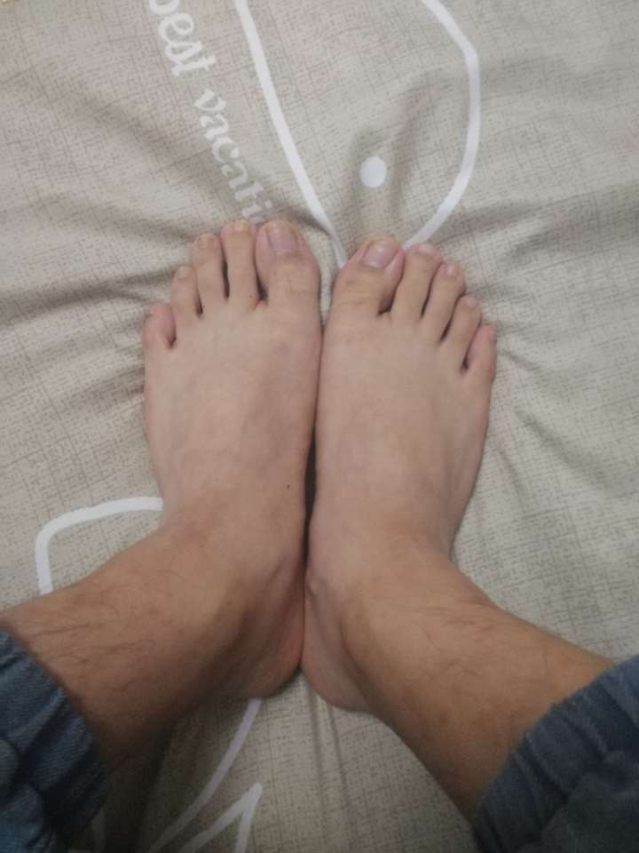 为什么有些人的第二个脚趾头比第一个长