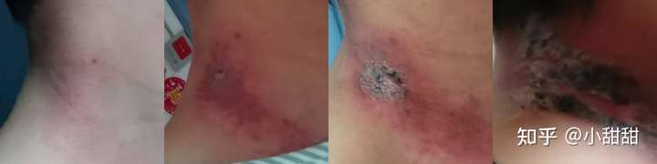 得了癌症是一种怎样的经历 知乎 得了癌症是一种怎样的经历 知乎