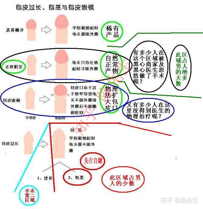 关于男生包皮要不要手术以及如何非手术治疗的问题 知乎