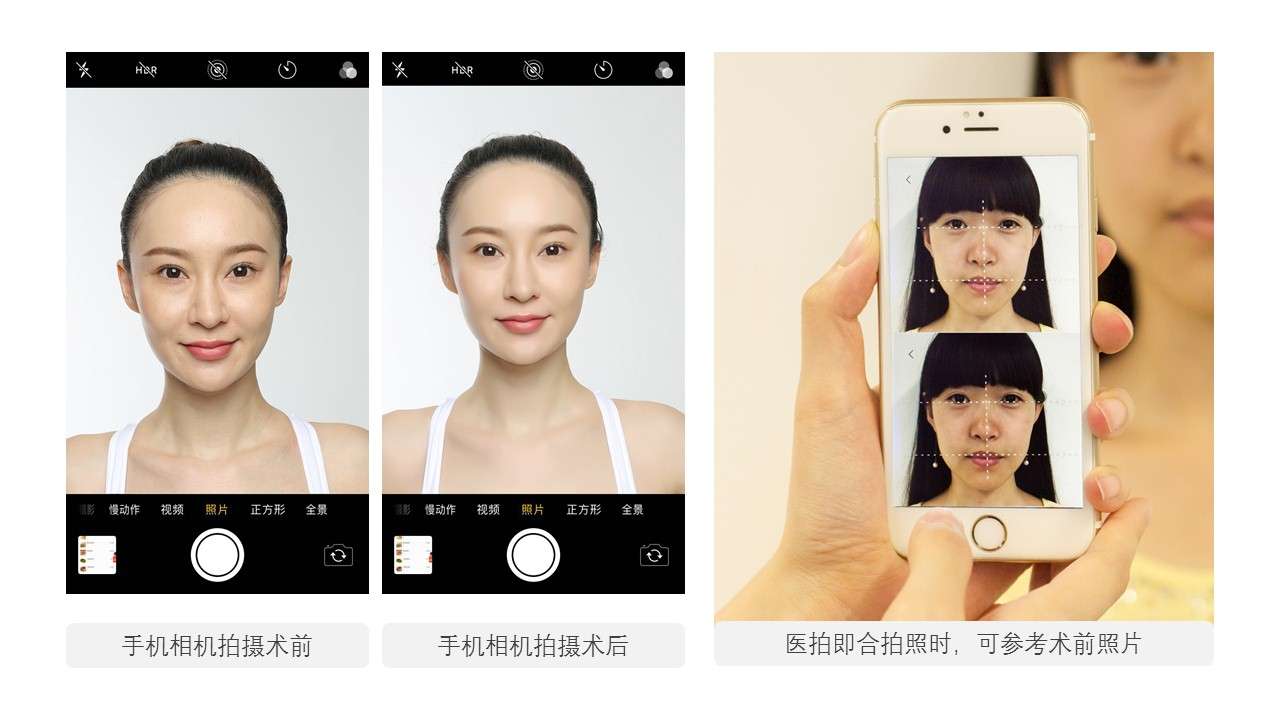 新 医疗专业相机术前术后分屏对比拍摄的傻瓜相机 知乎