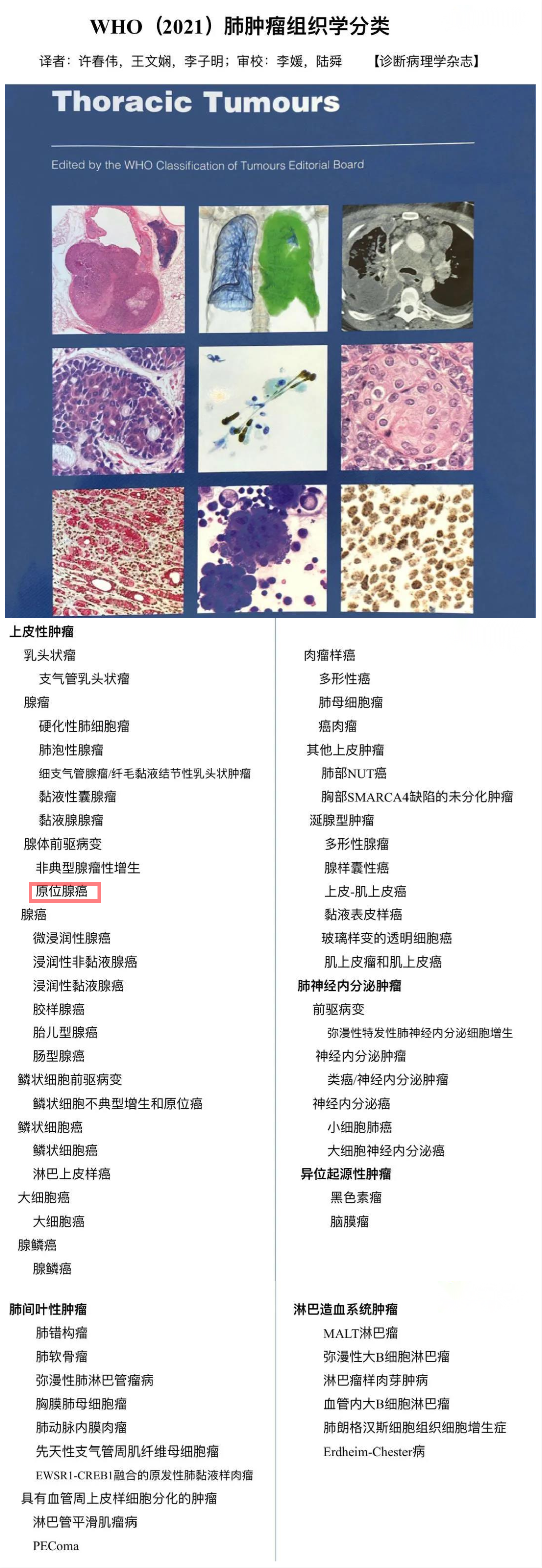 别怕 这种 癌 不是癌 肺原位腺癌被移出恶性肿瘤分类 知乎