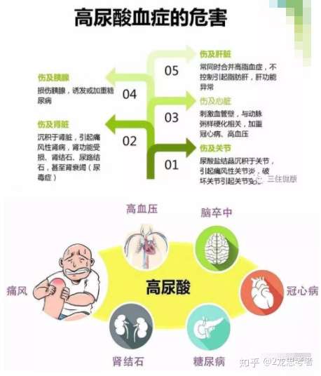 尿酸偏高的原因及治疗方法,你都知道哪些?