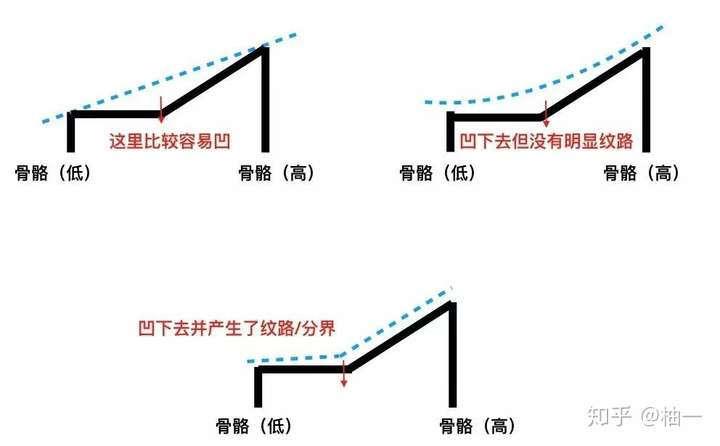 拿掉滤镜,比黑眼圈眼袋更可怕的是泪沟和法令纹!(图6) 拿掉滤镜,比黑眼圈眼袋更可怕的是泪沟和法令纹!(图6)