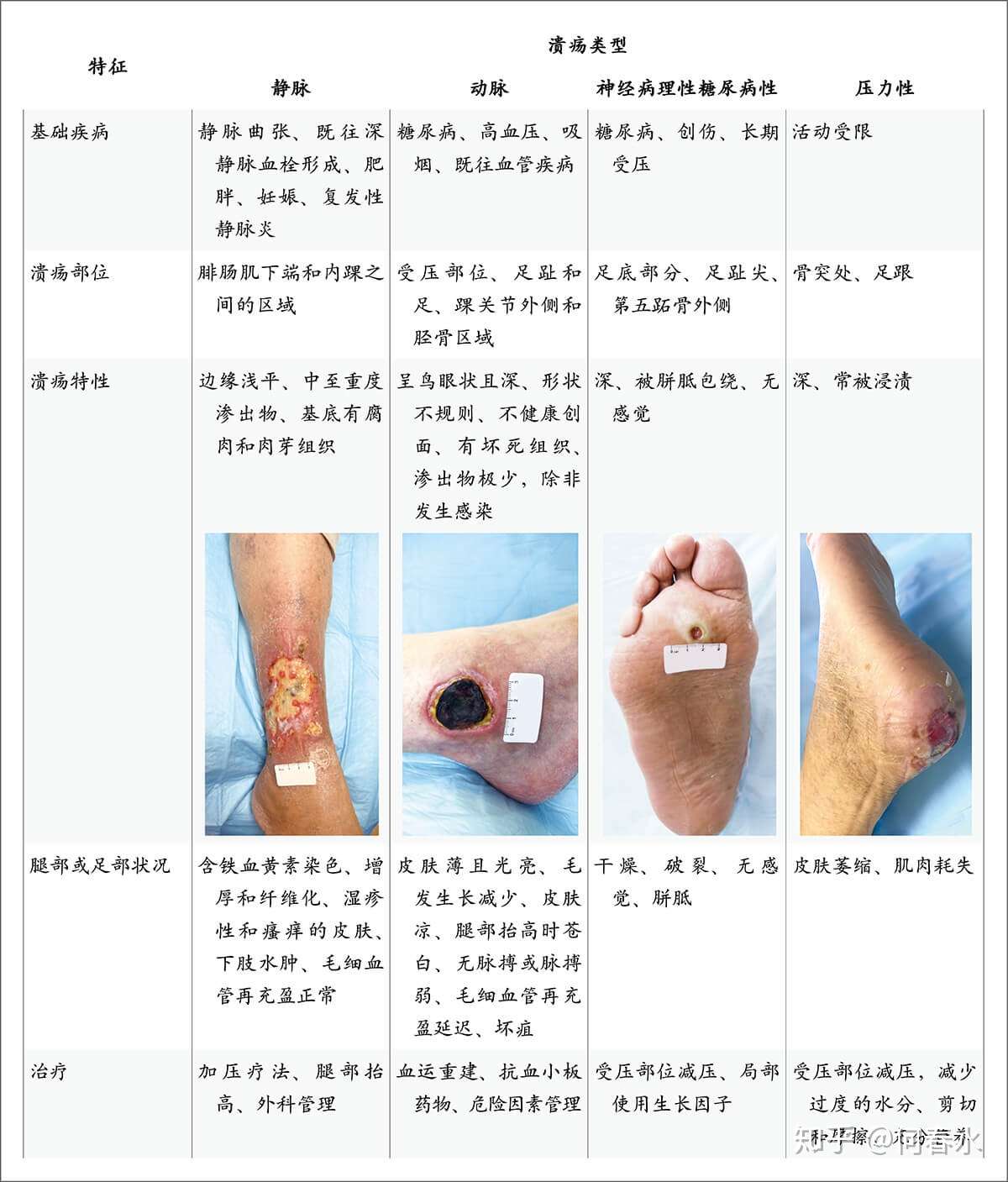 腿部皮肤变黑且有溃疡是什么原因 知乎