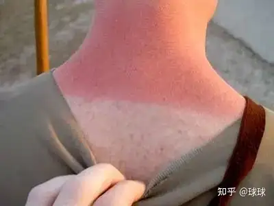 军训防晒攻略