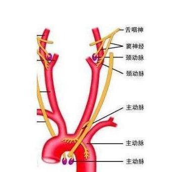 主动脉弓三个分支图解图片