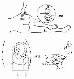 环跳的位置图图片