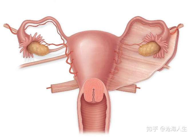 引起輸卵管堵塞的婦科疾病有哪些