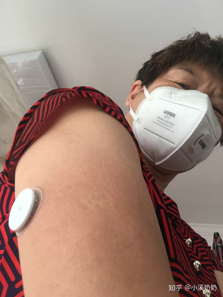 雅培瞬感使用心得