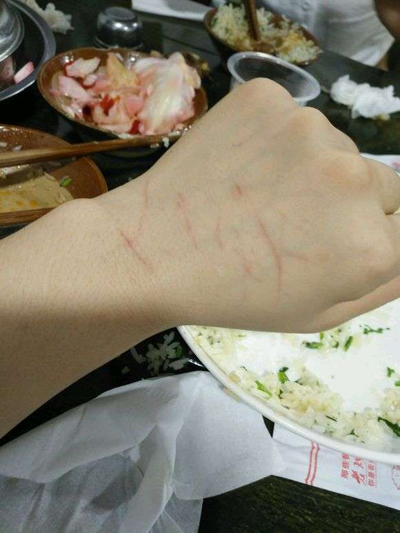 撸猫惨被猫抓伤怎么办如何训练猫咪避免猫咪抓人咬人