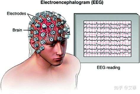 腦科學研究方法二腦電圖篇