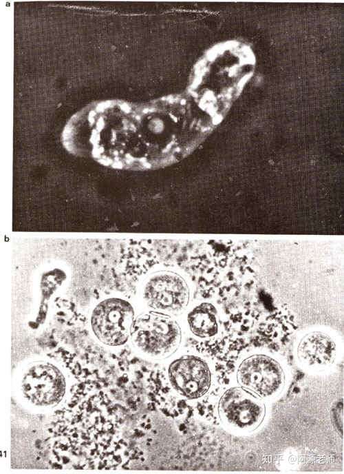 我们俗称的食脑虫到底是一种什么生物被感染后会怎么样