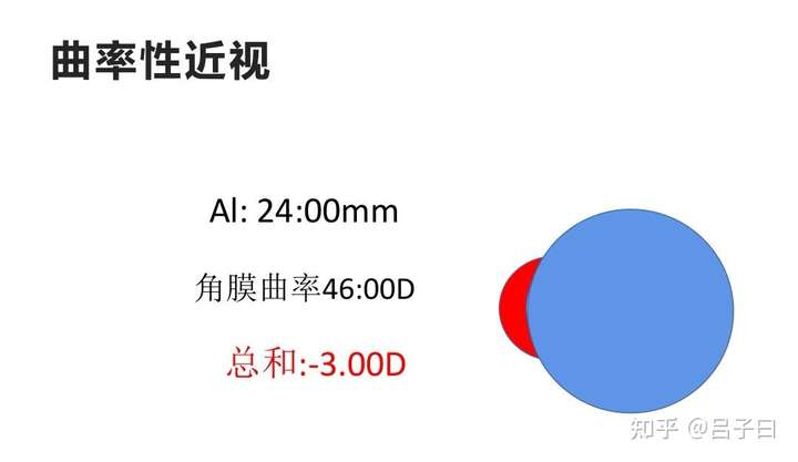 眼軸和度數嚴重不匹配的原因是什麼呢?