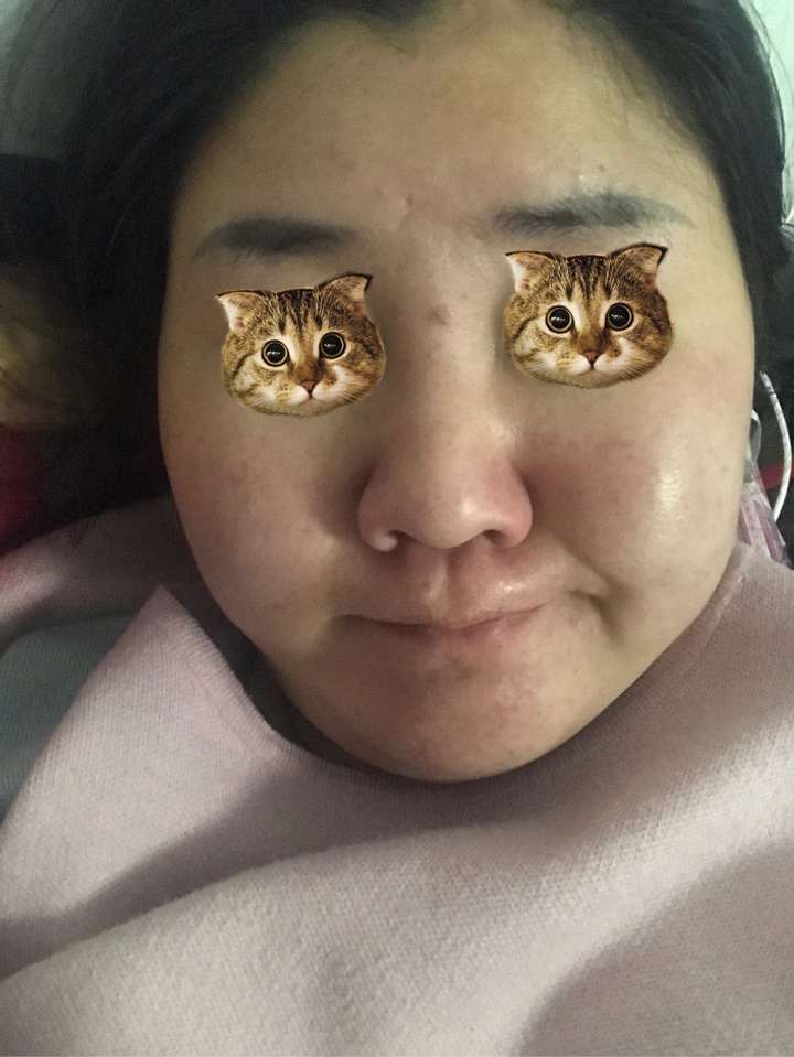 皮肤差的胖女孩会有男生喜欢吗?