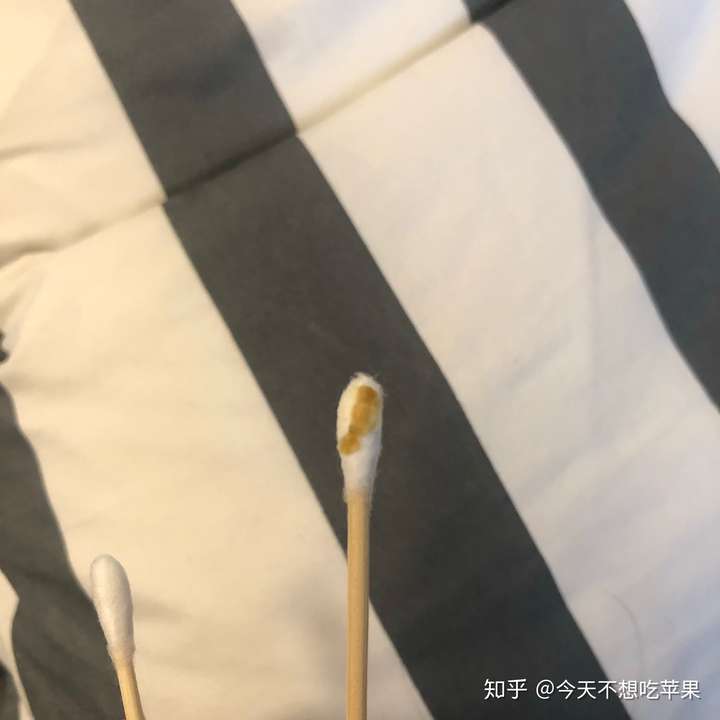 掏出一块超大耳屎,是种什么体验?