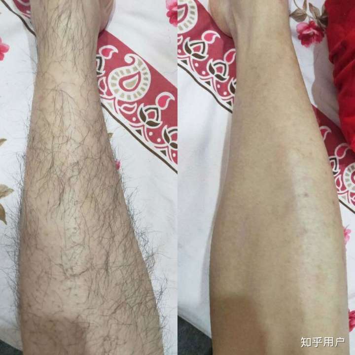 男生没有腿毛很羞耻吗