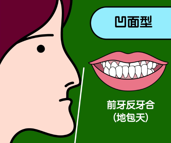 地包天要矫正吗