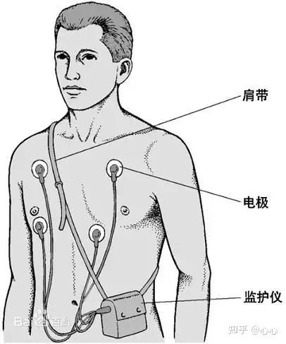 动态心电图( aecg) 通常也称为holter,是以研发者美国物理学家norman