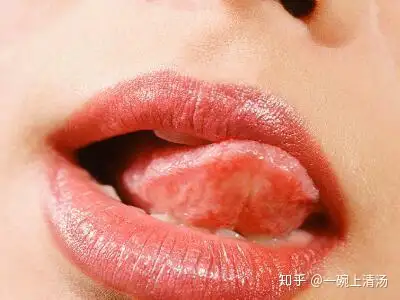 舌尖边缘两侧红色肉芽图片