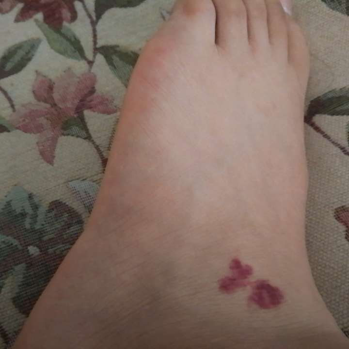 我出生后发现脚上有红色的胎记 妈妈说越看越像梅花哈哈哈 我妈还调侃