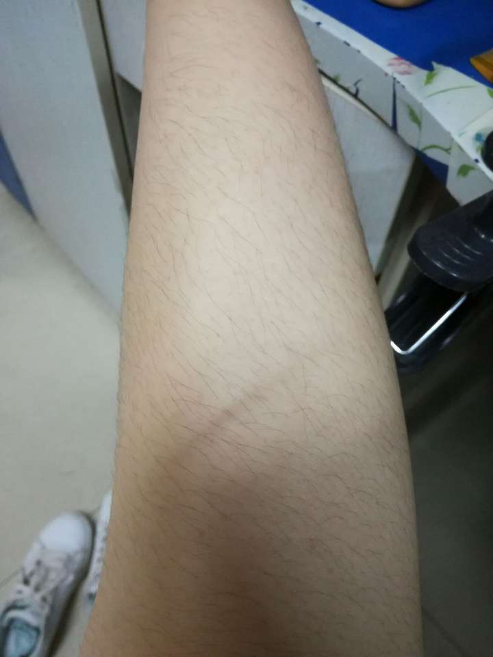 大家都怎样看待女孩不刮腿毛穿短裙短裤长腿毛的女生夏天怎么穿既凉快