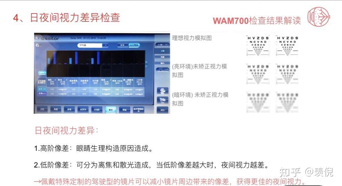 配眼镜用wam700仪器可以检查什么 知乎