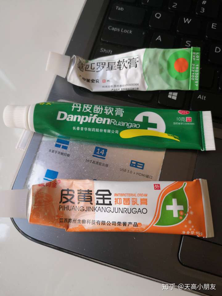 過敏問題:我是油性皮膚,伴隨反覆起痘,介紹下我家裡現在有的的藥膏