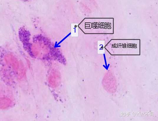 疏松结缔组织巨噬细胞图片