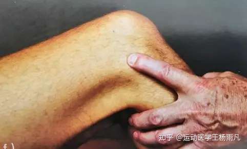 跑步得了髂胫束综合症怎么办?