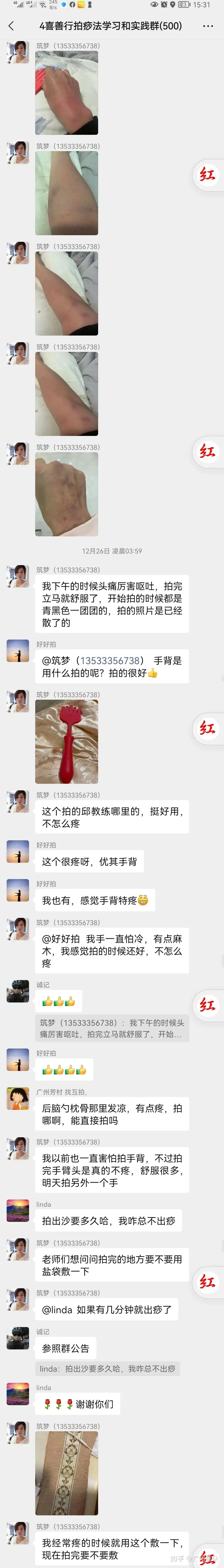 头痛和呕吐 为什么拍打手臂手背能好 知乎