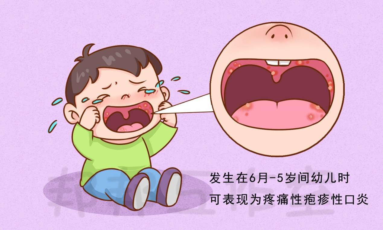来了就不愿走的单纯疱疹该怎么办 知乎