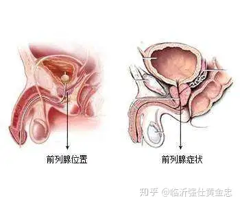 男性前列腺大科普你真的瞭解前列腺嗎