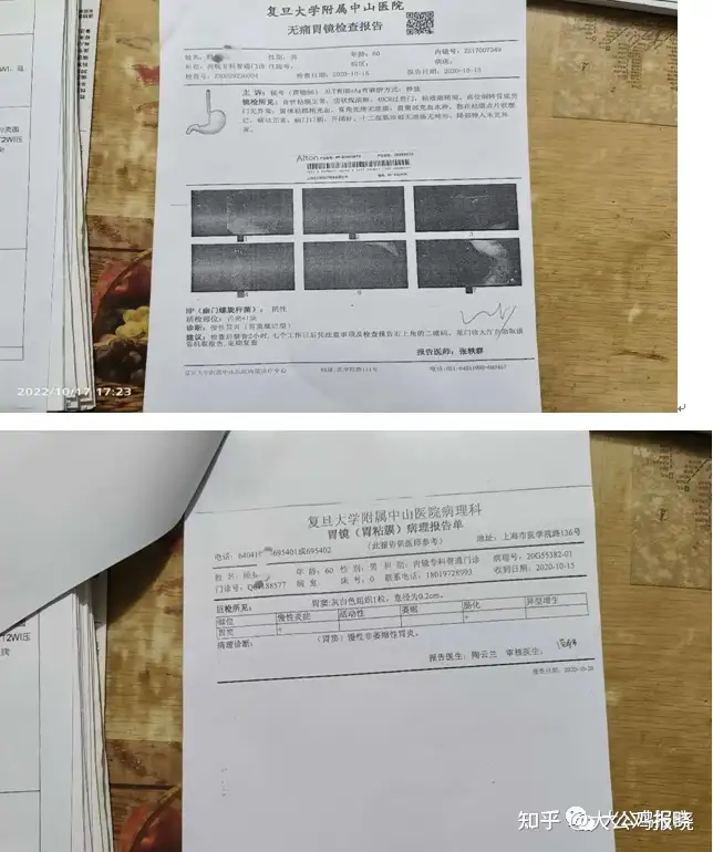 大公鸡报晓