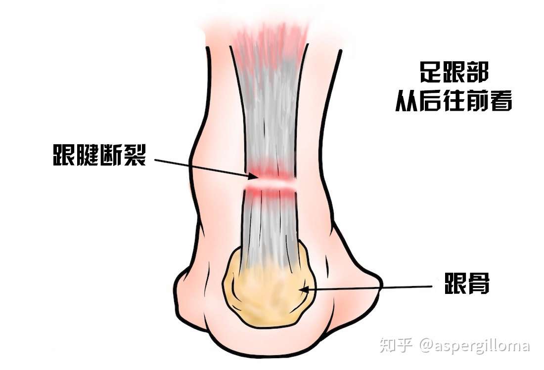 你真的了解肌腱吗 知乎