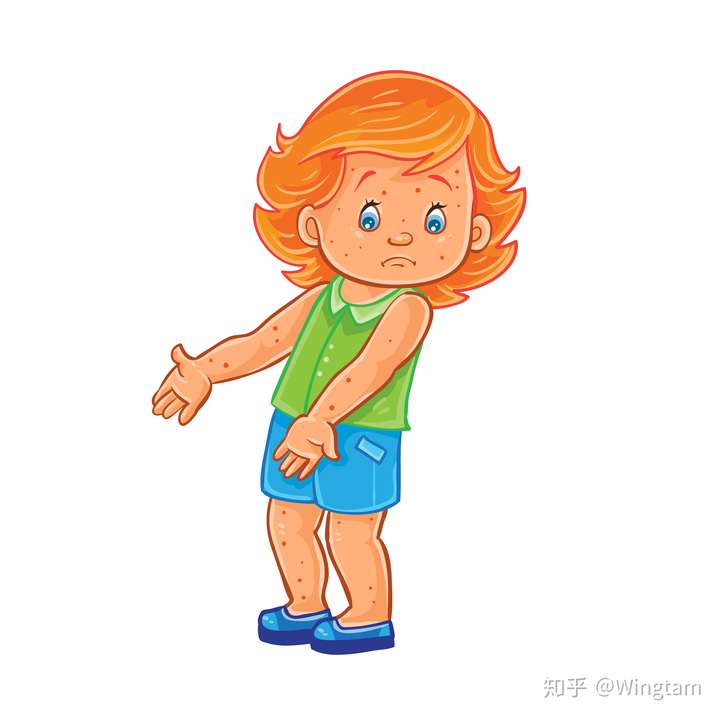 人被蚊虫叮咬后甚至会出现局部皮肤的肿胀,剧烈瘙痒不适,甚至全身症状