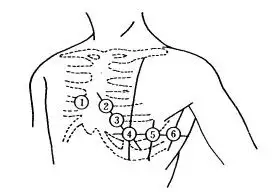 心电图12导联连接示意图