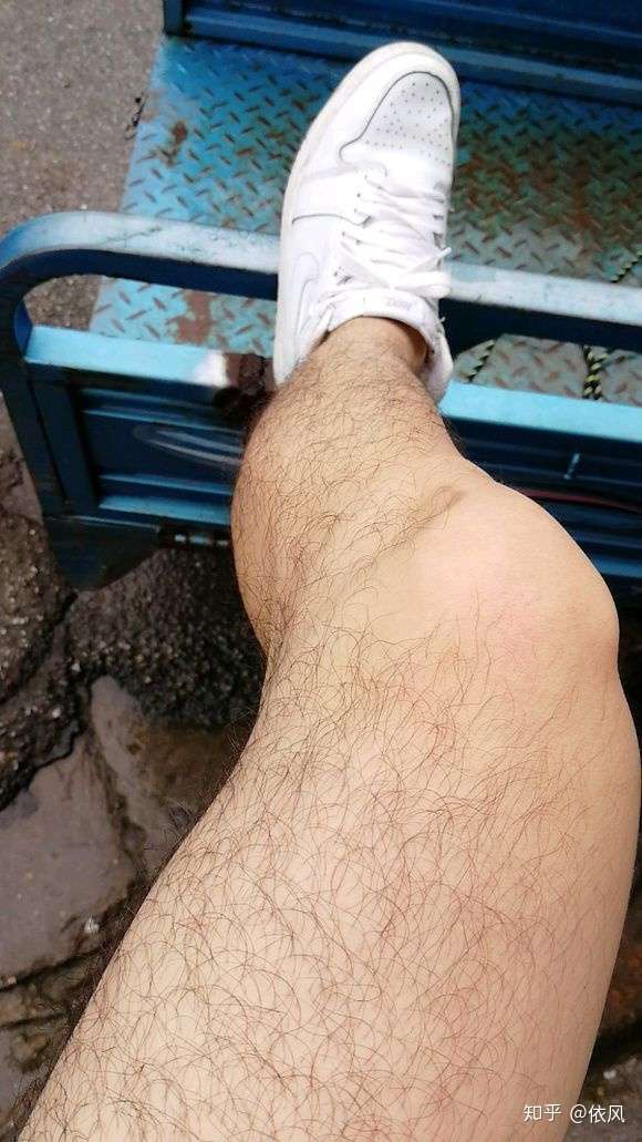 为什么腿毛多还长百科在线 为什么腿毛多还长百科在线