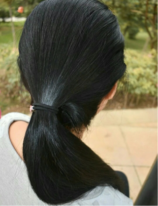 脱发严重有什么办法吗? - 知乎