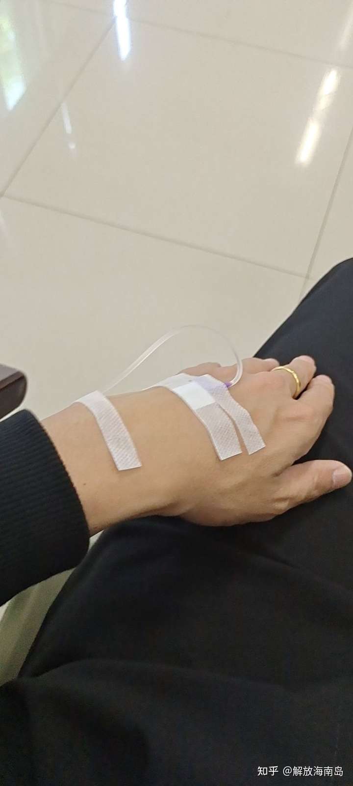 如何判断横纹肌溶解?