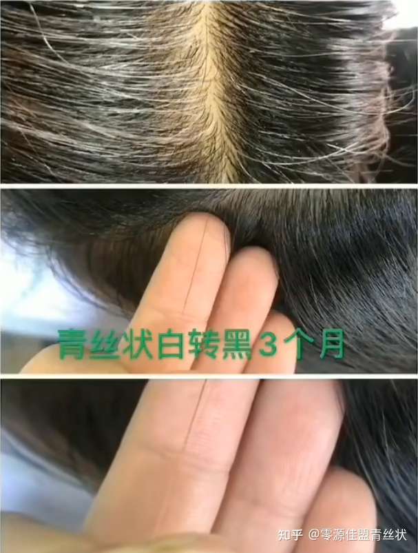 漂头发对毛囊的损伤多久能恢复?