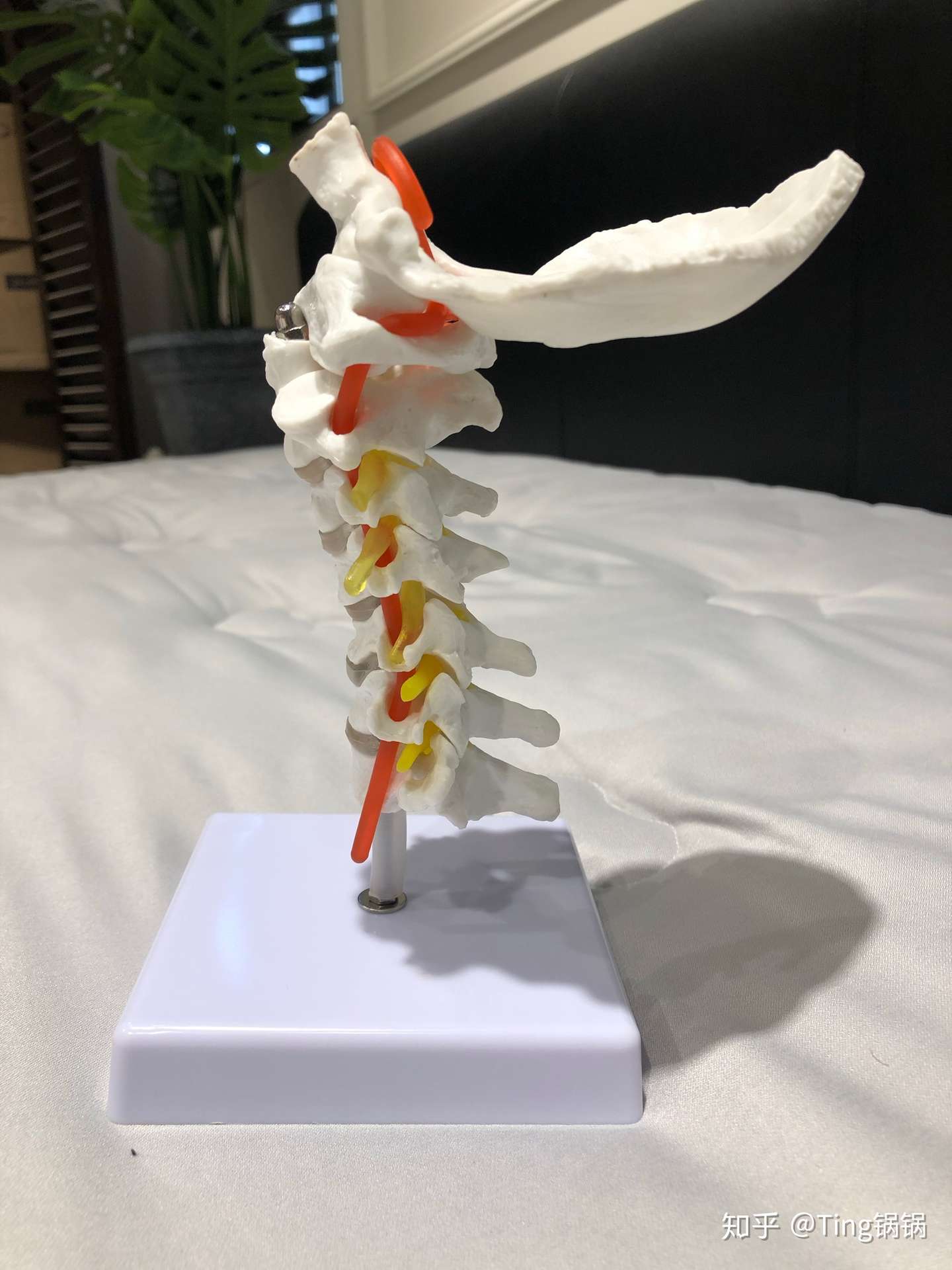 颈椎曲度变直 反弓 颈椎病应该睡什么样的枕头 知乎