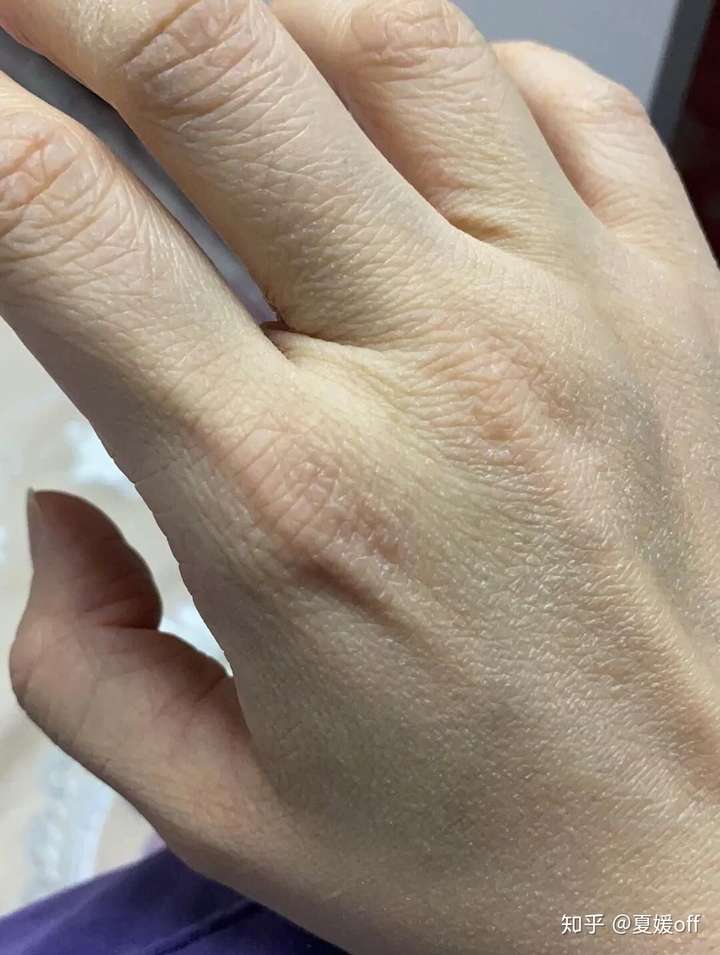 手粗糙成这样还有救吗