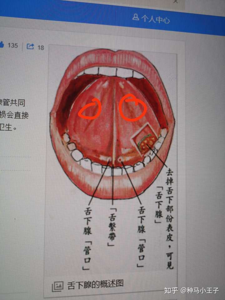 舌下腺在哪个位置图片图片