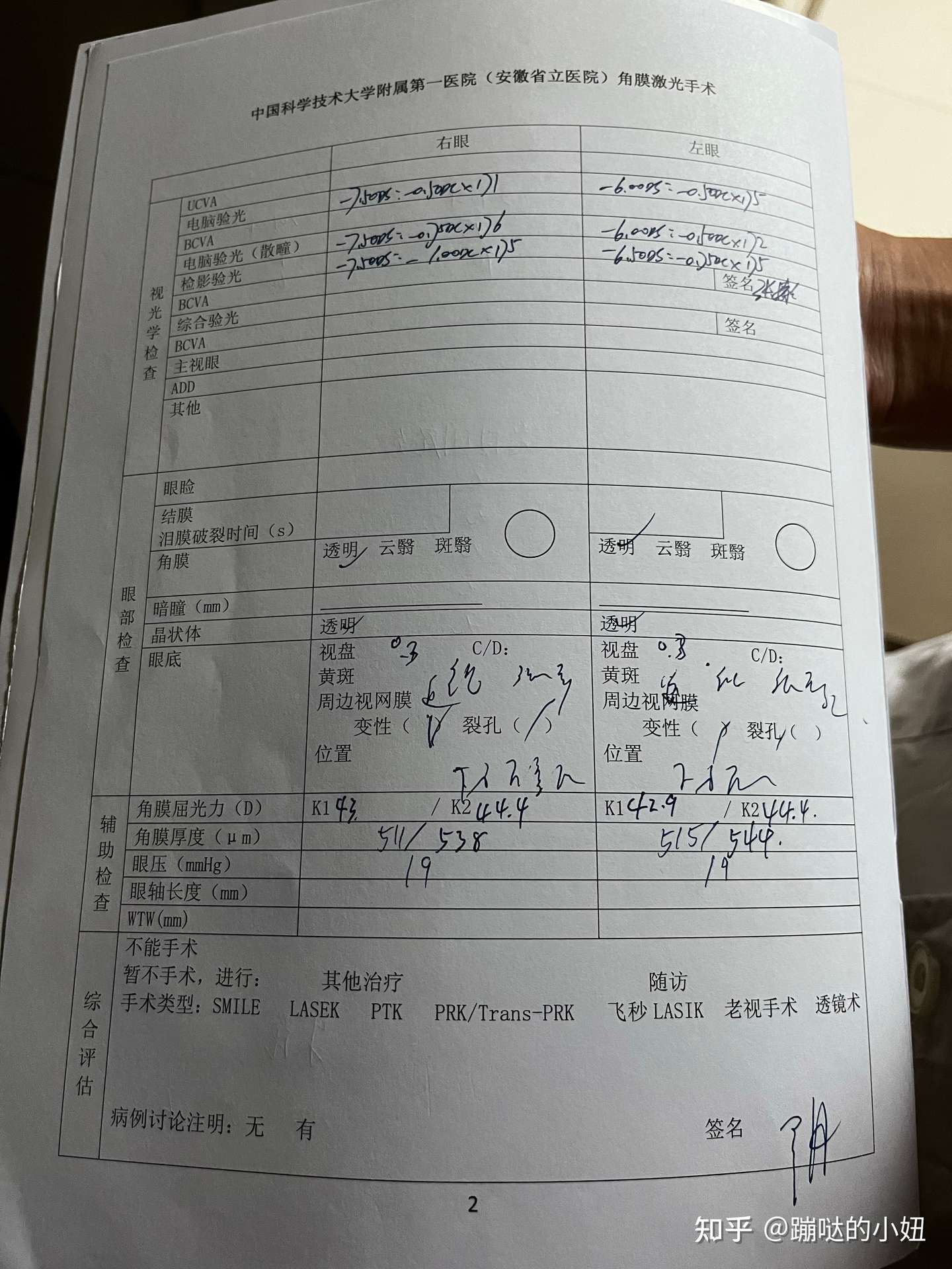 全飞秒手术感想 700度近视100度散光 知乎 全飞秒手术感想 700度近视100度散光 知乎