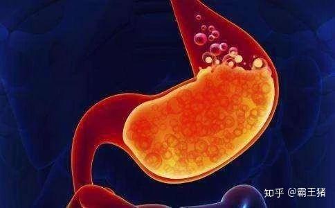 胃酸反流一定是胃酸过多吗 一起来了解我们的胃酸 知乎