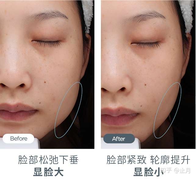 美容仪是智商税吗 21性价比超高的美容仪推荐清单 含宙斯 雅萌 Nuface等12款美容仪实测 知乎