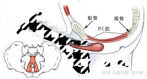 pc肌位置图片图片