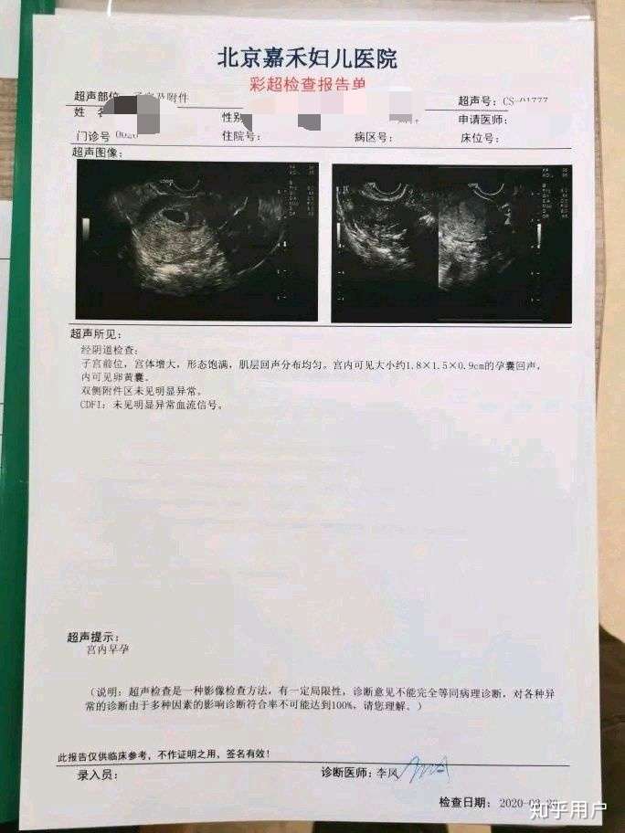 想问问关于微管可视无痛人流手术?